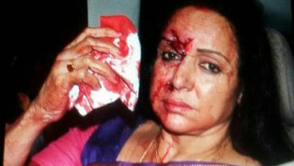 সড়ক দুর্ঘটনায় আহত হেমা মালিনী
