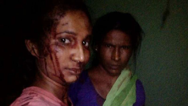 ছাগল বাঁচাতে বাঘের সঙ্গে তরুণীর লড়াই